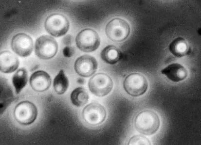 Pasteuria spores